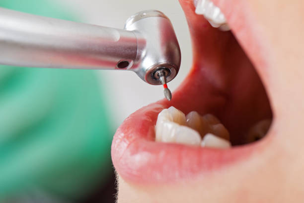 Emergency Dentist Open Today in IN